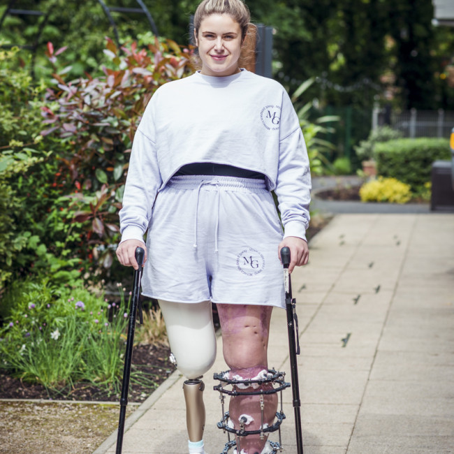 Scala Assists in Organising the STEPS Rehabilitation and STEPS Prosthetics Amputee Conference 2024